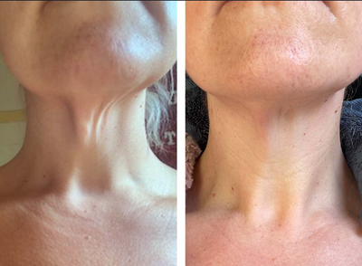 Anvera™ Crepey Skin Repair Cream